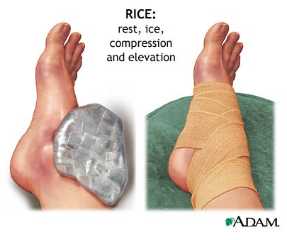 lábfej sérülések nem szteroid gyógyszerek ízületi fájdalmakra