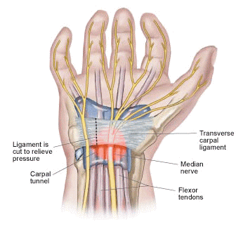 csukló ligamentum-töréskezelés