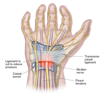 guyon alagút subacute thyroiditis recovery time