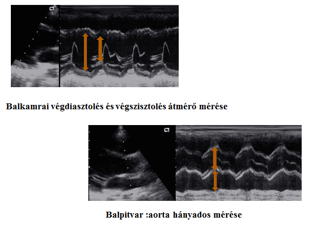 cardialis decompensatio)